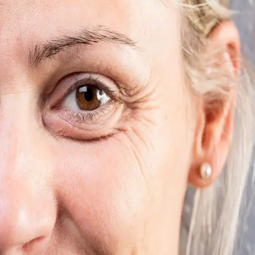 Blot Under-Eyes Midday