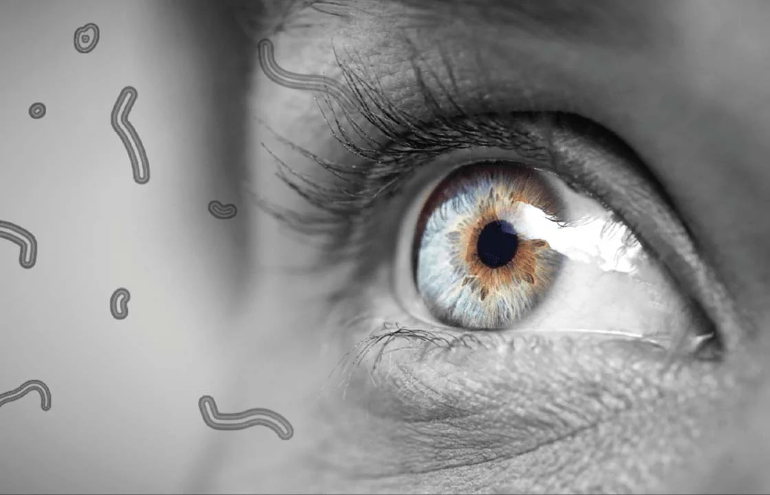 Get Rid of an Eye Floater
